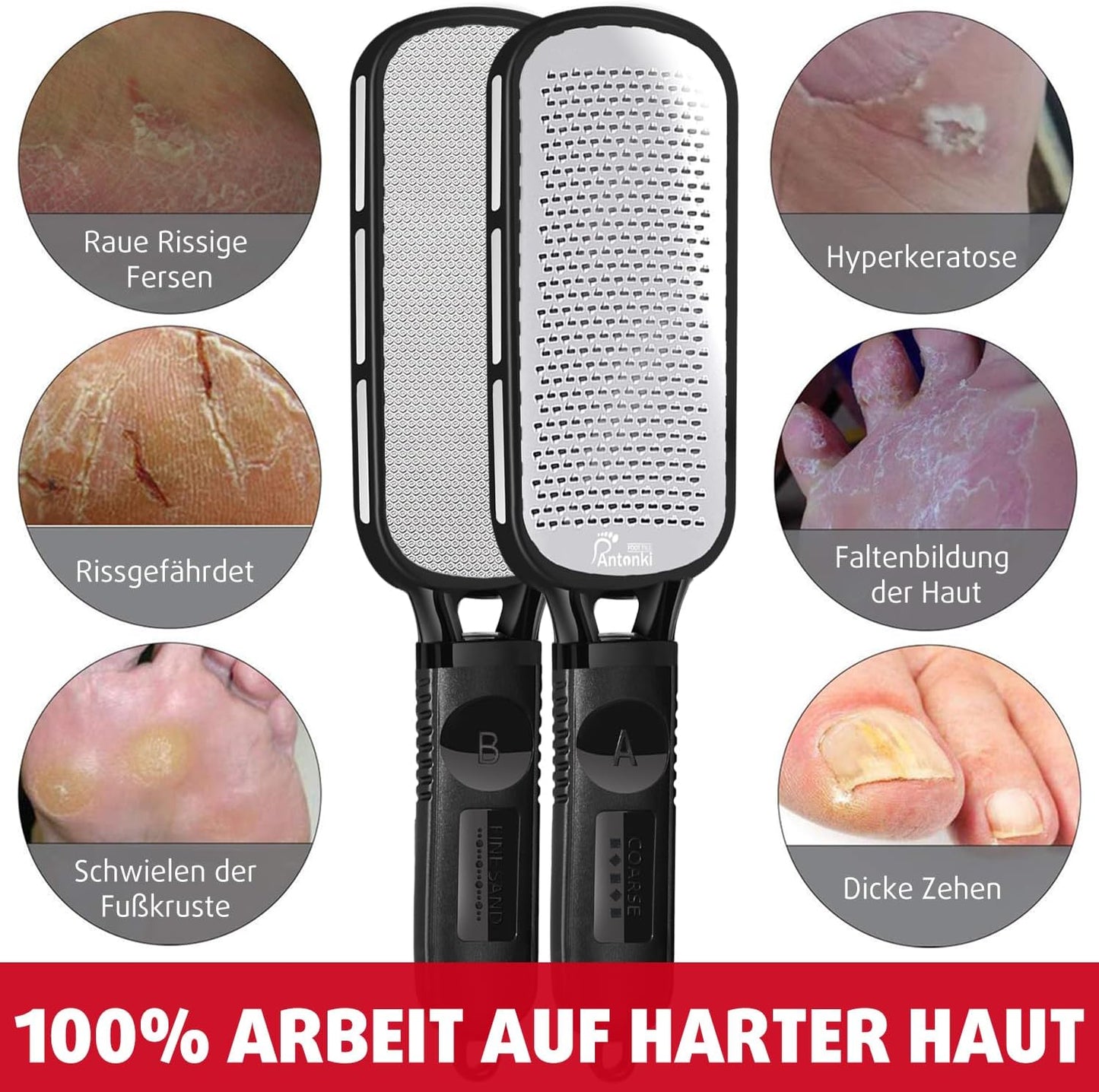 Antonki Hornhautfeile Fußfeile, Doppelseitig Hornhautraspel Hornhautentferner Für Fußpflege, Raspelfeilen, Professionelles Pediküre Werkzeug Hautfreundlichen Metall Fußfeile